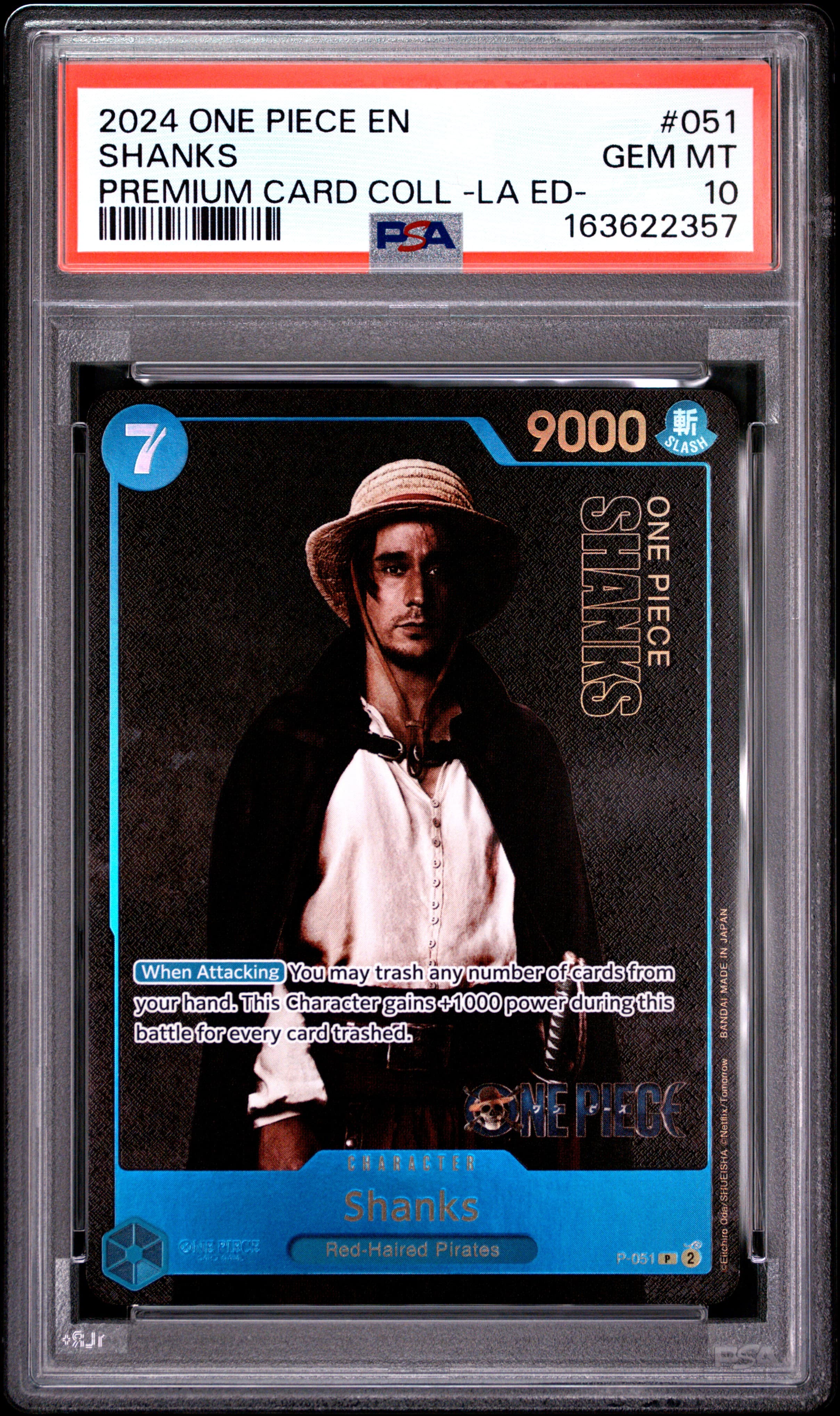 Shanks